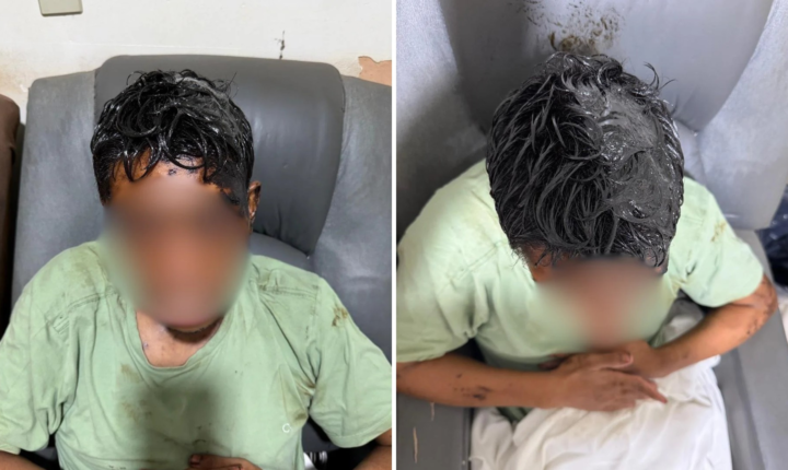 Homem com deficiência intelectual é coberto de óleo diesel queimado e precisa raspar cabelo: ‘Maldade’, diz avó