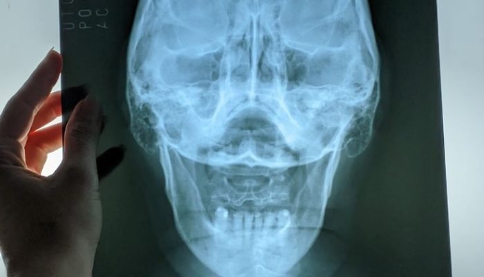 1908c7d3c2e6f9f902b4055be72488e0