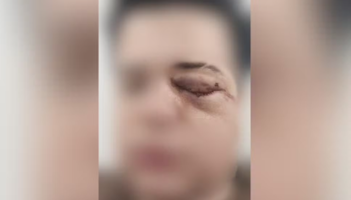 Captura de tela 2026-03-31 102248