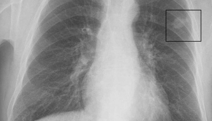 f10484749ee2bbaa4341357bc3674fab