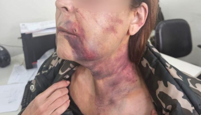 idosa-agredida-e1756494428206