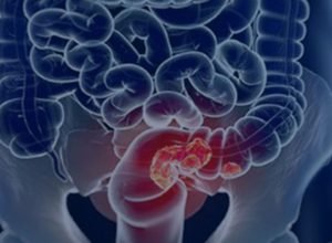 © Câmara Municipal de Afonso Claudio/Divulgação